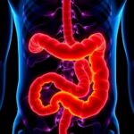 Increase In Colorectal Cancer Among Young Adults In Germany Observed—Still Lower Than Us Rates 1782215311