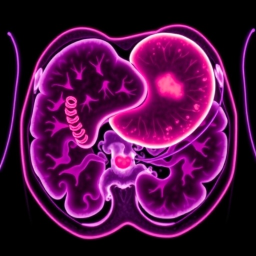 Infigratinib Shows Promise For Fgfr2 Positive Gastric Cancer 1782206316