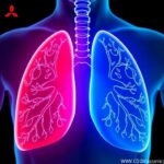 Innovative Advances Propel Personalized Lung Cancer Treatments Forward 1781549305