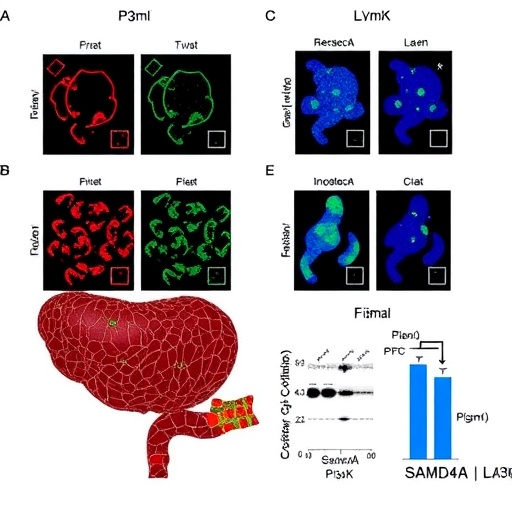 Lamb3 Boosts Gastric Cancer Via Samd4A And Pi3K 1781727623