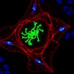 Laser Links Damage Detection To Lysosome Repair 1780518809