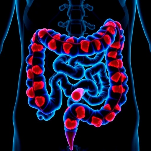 Leukocyte Levels Linked To Colorectal Cancer Survival 1780516879