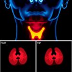 Light Based Imaging Advances Promise Enhanced Thyroid Cancer Diagnosis And Fewer Surgeries 1782326972