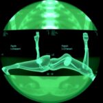 Marshall Health Network And Intermed Labs Pioneer Next Generation Surgical Visualization With Spatial Arthroscopy 1780518871