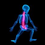 Meta Analysis Evaluates Duchenne Muscular Dystrophy Treatments8217 Safety 1782854530