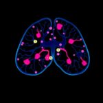Methylation Ctdna Tracks Metastatic Breast Cancer Therapy 1780606411