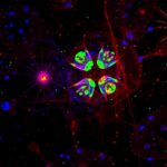 Microglial Cd31 Hinders Aβ Clearance Worsens Alzheimer8217S 1780705523