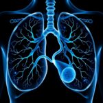 Multimodal Multitask Ai Transforms Lung Cancer Grading 1781740714