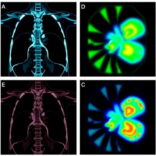 New Integrated Pet Imaging Platform Quickly Identifies Clear Surgical Margins In Osteosarcoma Resection 1780432957