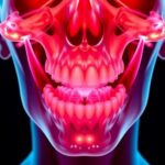 New Invasion Drivers Define Oral Tumor Front 1782003318