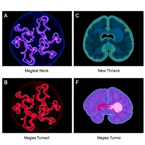 New Research Uncovers Challenges Hindering Antibody Based Therapies For Solid Head Neck And Pancreatic Tumors 1780478122