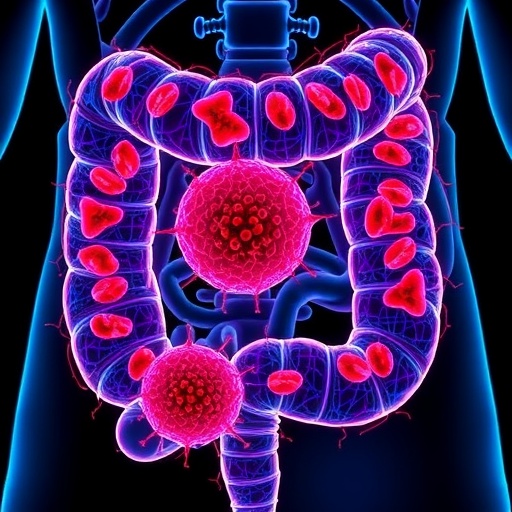 New Study Reveals Mechanisms Behind High Iron Levels In Colorectal Cancer Cells 1781734579