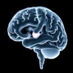 Optimal Echocardiography Timing In Neonatal Brain Injury 1782137741
