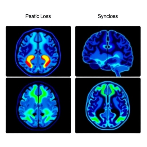Pet Imaging Uncovers Synaptic Loss In Multiple Sclerosis Insights From Preclinical And Human Studies 1780432364
