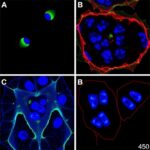 Plk4 Inhibitor Rp 1664 Shows Dual Action In Neuroblastoma 1781373686