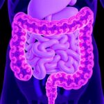 Paneth Cell Metaplasia A Potential Protective Mechanism In Ulcerative Colitis 1782150921