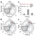 Patients With Isolated Rem Behavior Disorder Show Α Synuclein Negativity 1780685443