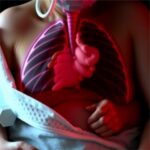 Predicting Difficult Intubation Outcomes In Congenital Diaphragmatic Hernia 1782211642