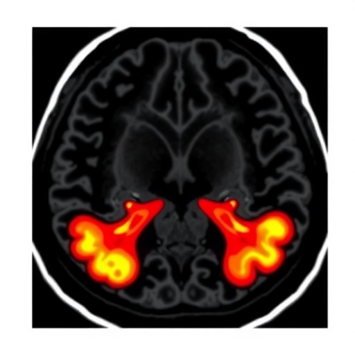 Prostate Mri Enhances Biopsy Accuracy And Outcomes 1780699646
