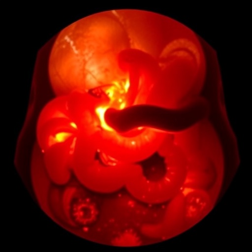 Rare Intestinal Tumor Mimicking Intussusception Sheds Light On Diagnostic Challenges In Young Women 1781126002