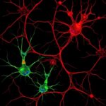 Reactive Astrocytes Drive Toxicity In Dopaminergic Neurons 1781265108
