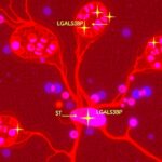 Secretory Lgals3Bp Drives Sepsis Liver Damage Via Pyroptosis 1782207335