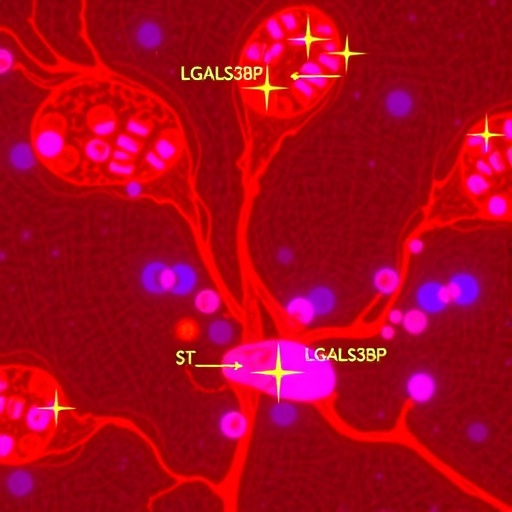 Secretory Lgals3Bp Drives Sepsis Liver Damage Via Pyroptosis 1782207335