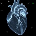 Seven Second X Ray Scan Precisely Measures Heart Valve Regurgitation Severity In Patients With Repaired Congenital Defects...