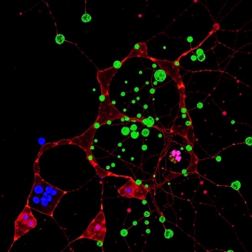 Single Cell Sequencing Uncovers Burkitt Lymphoma Evolution 1780955071