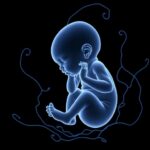 Sirolimus Treats Preterm Hydrops Linked To Vascular Anomalies 1782181349