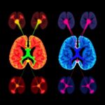 Thalamus Brainstem Network Shapes Biased Decisions 1781128718