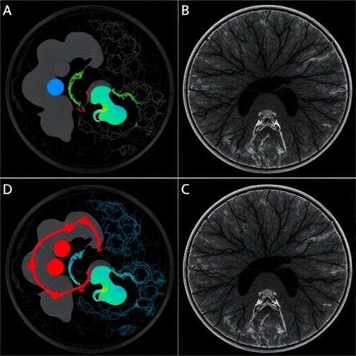 Tracing Metastasis And Evolution In Uveal Melanoma 1781709444