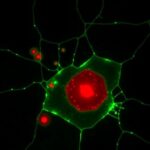 Tuberculosis Exploits Idh Pparγ To Trigger Macrophage Ferroptosis 1780958742