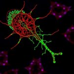 Tumor Promoting Role Of Msx1 In Cervical Cancer 1780701921