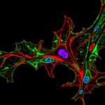 Tumor Wnt7A Drives Lung Fibroblast Changes Boosts Metastasis 1780516820