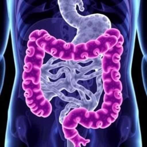 Tumour Deposits Drive Immune Evasion Worsen Colorectal Prognosis 1781276064