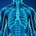 Ibuprofen As Adjunct In Drug Resistant Tuberculosis Trial 1782911162