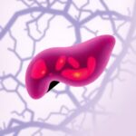 Steatosis Drives Liver Metastasis Diversity In Crc 1782991302
