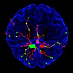 Validating 18F Thk5351 For Imaging Astrogliosis 1782960987