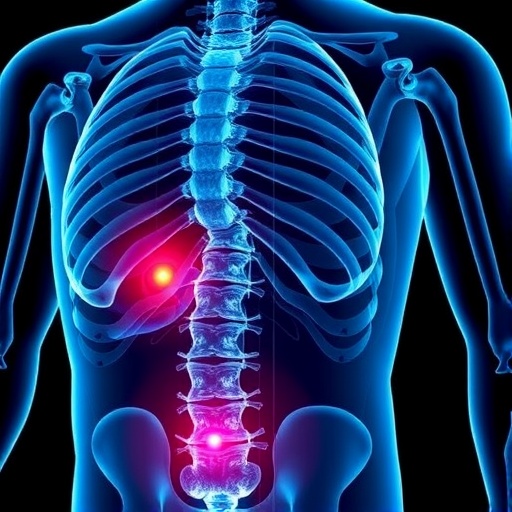 Blocking Siglec Binding Sialoglycans To Halt Prostate Cancer Bone Spread 1783935922