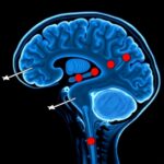 Deep Learning Detects Rem Sleep Disorder And Parkinsons Early Via Fmri 1784010257