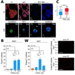 Hepatoselüler karsinomda TACE direncine dair TKT–c-Myc döngüsü: Cell Death Discovery’de yayımlanan düzeltme tekrar gündemde