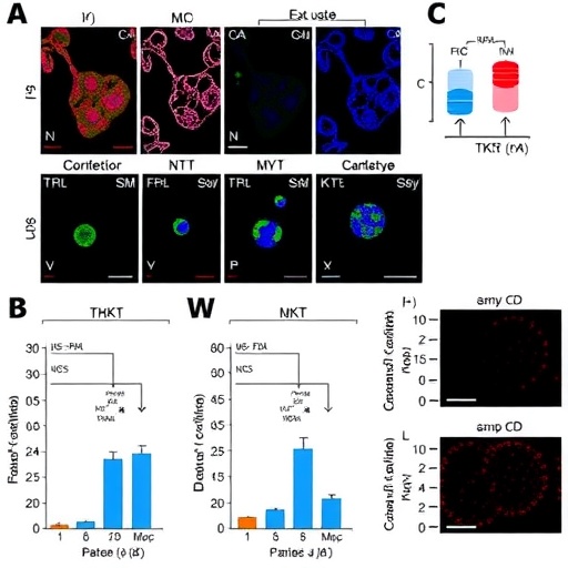 Hepatoselüler karsinomda TACE direncine dair TKT–c-Myc döngüsü: Cell Death Discovery’de yayımlanan düzeltme tekrar gündemde