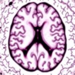 JAMA Vaka Raporu: Alzheimer’da Amyloid Temizliğinin Neden Bazı Bölgelerde Daha Etkili Göründüğü İncelendi