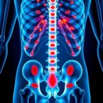 Kras Drugs Offer New Hope For Rare Appendix Cancer Treatment 1783994957