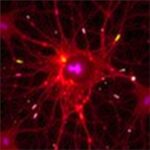Lezyon sonrası onarımda “astrocyte kimlik kaybı” ve çekirdek göçü keşfi