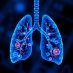 Multi Metal Cooperation Drives Lung Cancer Chemoresistance Reversed By Miadmsa 1783363752