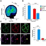 Pycnogenol, thioacetamide toksisitesinde hem beyin davranışını hem de karaciğer hasarını çoklu yollardan baskılayabilir