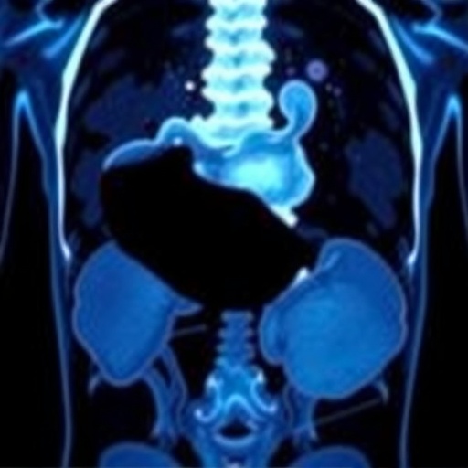 Second Psma Pet Scan Alters Treatment In Almost Half Of Prostate Cancer Cases 1783657278