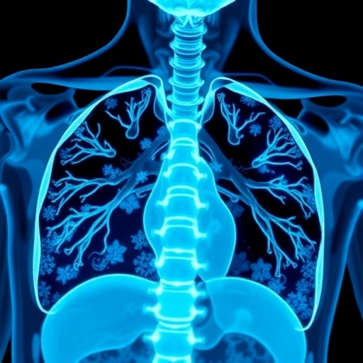 Years Algorithm Enhances Pulmonary Embolism Diagnosis In Cancer Patients 1783845735